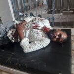 पत्नी को लेने गए पति सहित तीन पर ससुराल पक्ष ने किया जानलेवा हमला